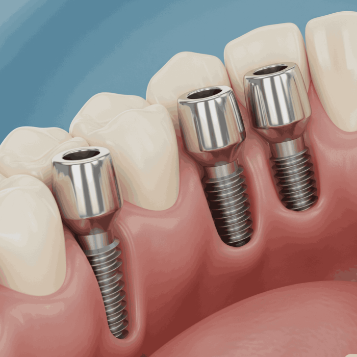 Gemini_Generated_Image_ltmladltmladltml_11zon